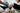 Can Compression Socks Cause Bruising